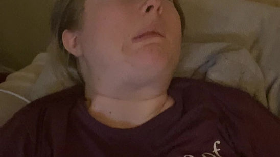Facial Spasms